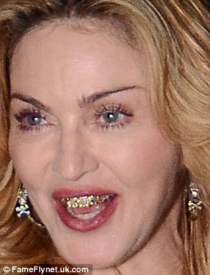 Madonna gold teeth